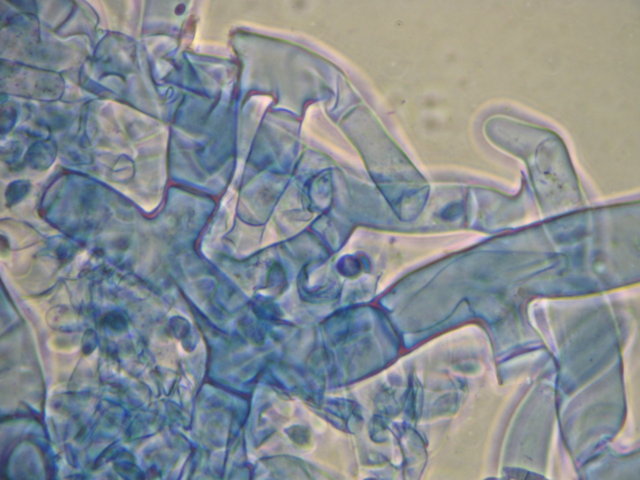 Botryobasidium con spore finemente verrucose